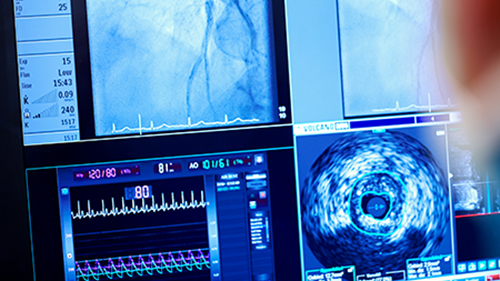 Kategoria &mdash; kardiologia