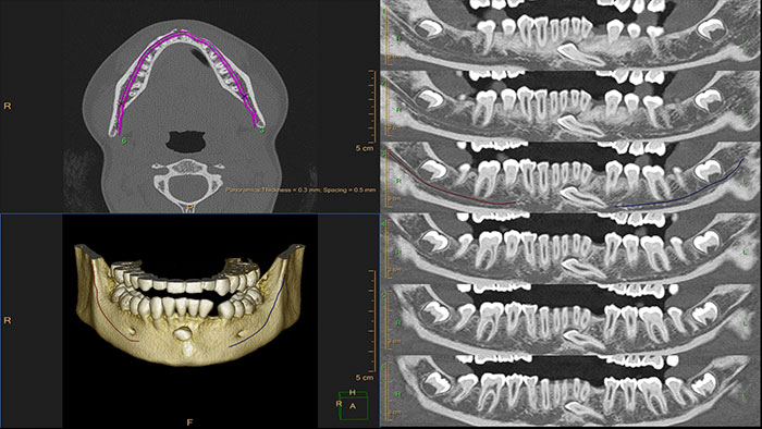 Dental Planning &mdash; miniatura