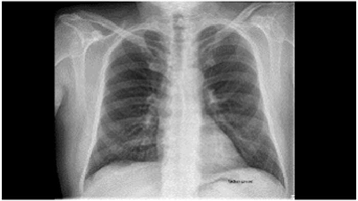 Aplikacja DXR Viewing &mdash; miniatura