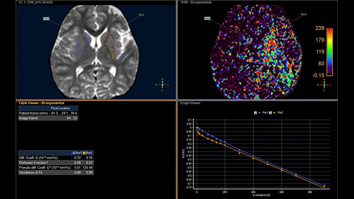 Miniaturka zaawansowanej analizy dyfuzji