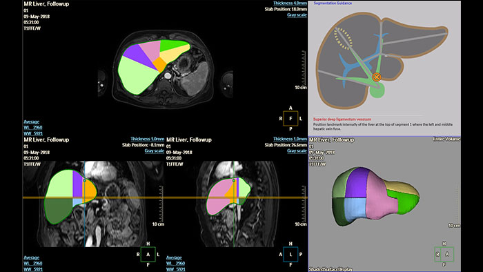 Aplikacja Liver Health &mdash; miniatura