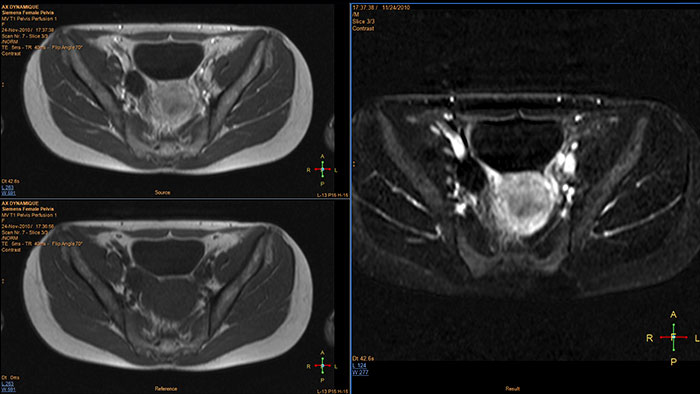 Miniatura odejmowania
