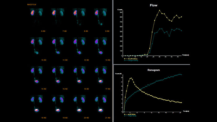 Pakiet Processing Application Suite &mdash; miniatura