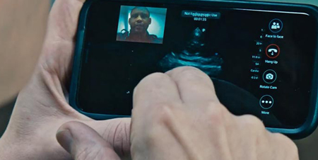 Przenośna ultrasonografia dzięki aplikacji Lumify miniatura klipu wideo