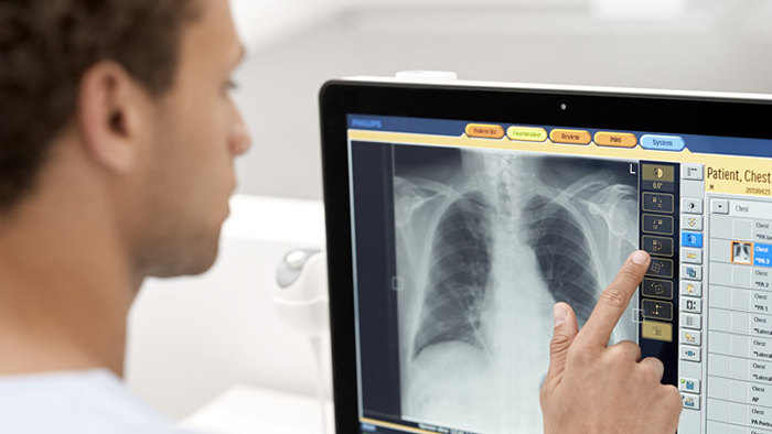 Oprogramowanie do obr&oacute;bki obraz&oacute;w RTG Unique 2