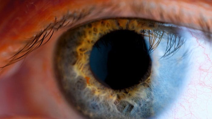 System ultrasonografii interwencyjnej EPIQ CVxi