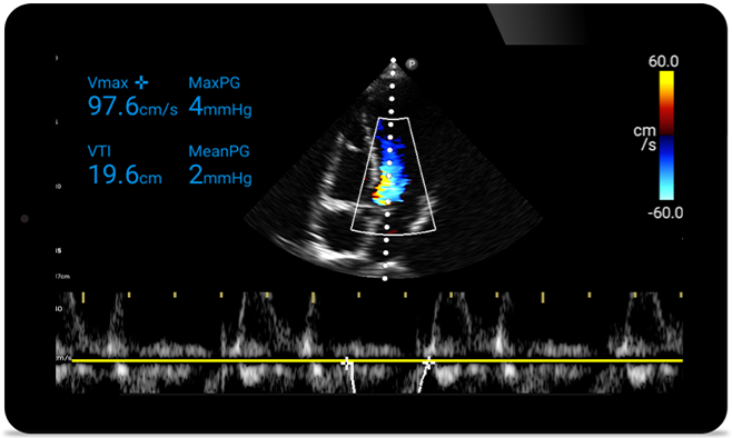 Jeśli w grę wchodzi serce, liczy się każda sekunda