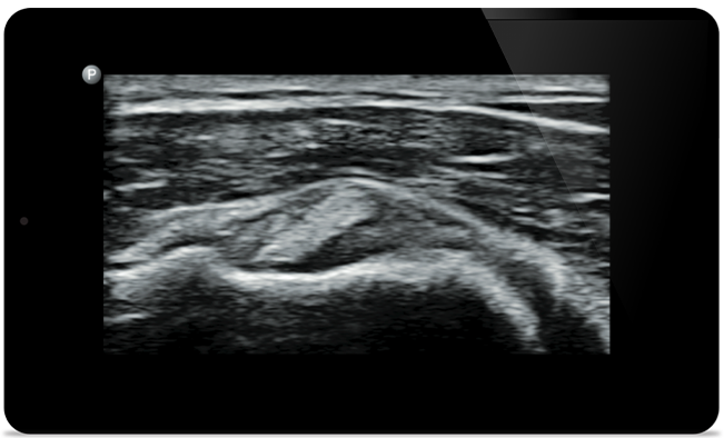 Dobra diagnoza jest podstawą właściwego leczenia