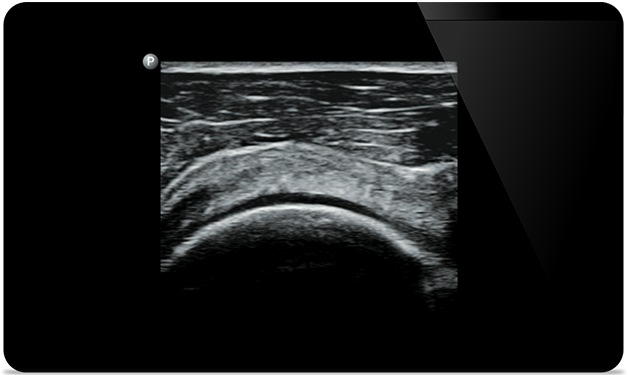 Możliwość zobrazowania całego ciała pozwala szybko podjąć właściwe działanie