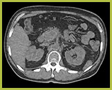 Badanie wykonane metodą &bdquo;H2O no iodine&rdquo;