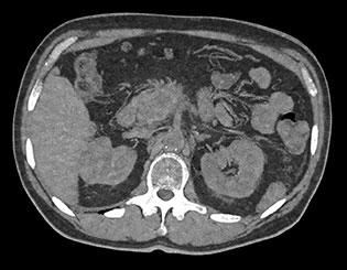 Badanie wykonane metodą &bdquo;H20 no iodine&rdquo;