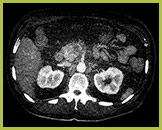 Badanie wykonane metodą &bdquo;Iodine no H2O&rdquo;