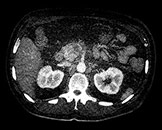 Badanie wykonane metodą &bdquo;Iodine no H2O&rdquo;