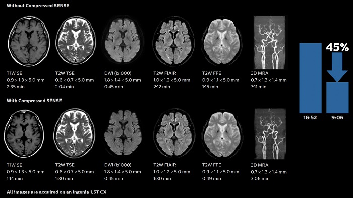 Jak wygląda wnętrze urządzenia Mr
