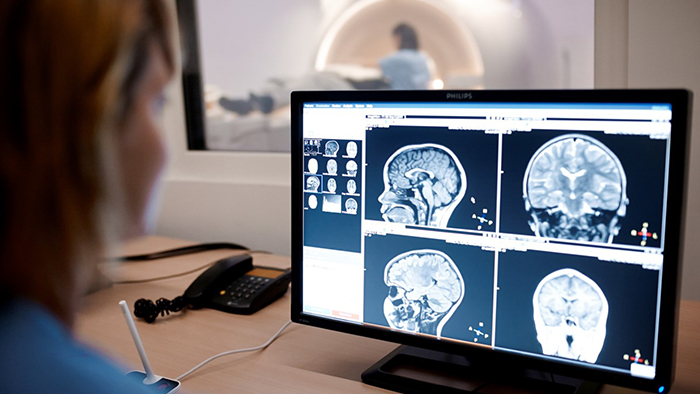 Technik przeglądający tomografię m&oacute;zgu