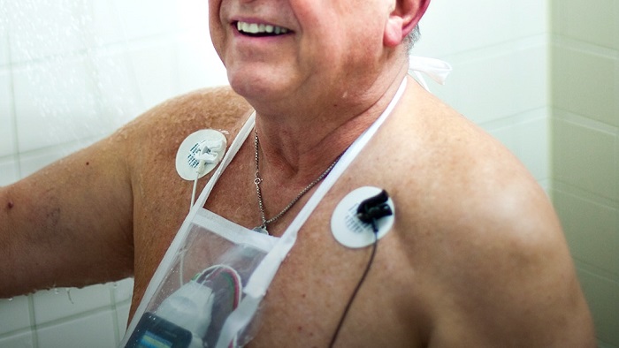 Urządzenia do monitorowania stanu noszone przez pacjent&oacute;w mobilnych