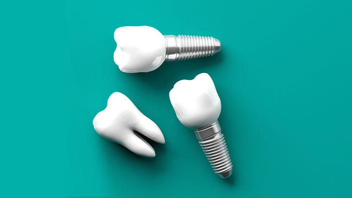 Codzienna higiena pacjent&oacute;w implantologicznych