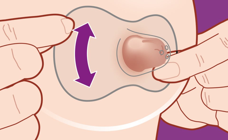 Spos&oacute;b nakładania nakładki silikonowej na brodawce.