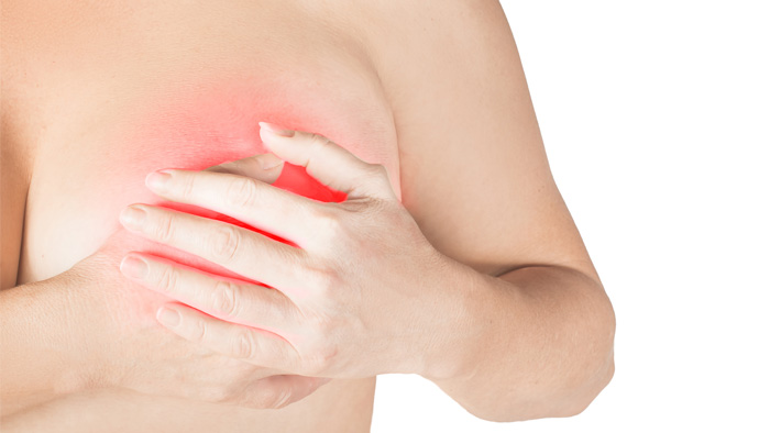 Zapalenie piersi - objawy, przyczyny, leczenie