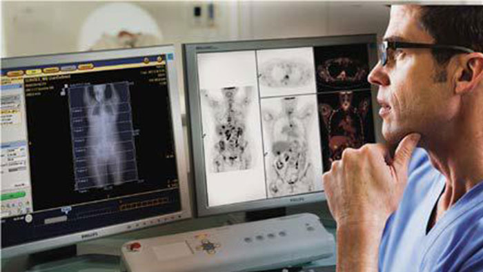 Ocena przydatności cyfrowej tomografii PET/CT &mdash; miniatura