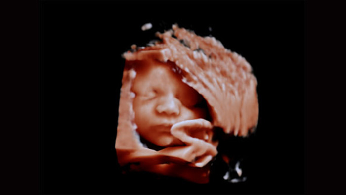 Widok płodu w tradycyjnej ultrasonografii
