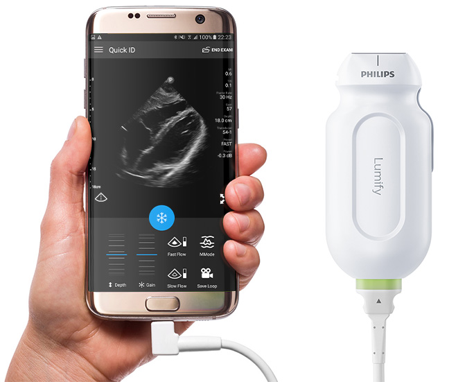 Aplikacja Lumify w&nbsp;systemie Android i&nbsp;IOS
