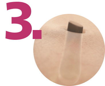 Wypadanie włosk&oacute;w po zabiegu depilatorem Philips Lumea.