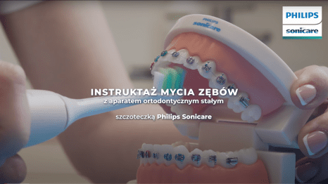 Instruktaż mycia zęb&oacute;w z aparatem ortodontycznym szczoteczką soniczną